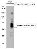 Anti-Paxillin (phospho Ser273) antibody used in Western Blot (WB). GTX132362